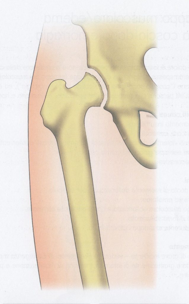 Displasia dell’anca