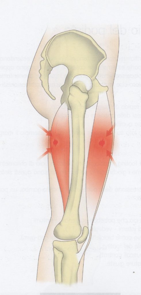 Stappo muscolare