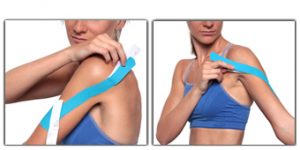 come applicare un nastro kinesiologico per taping scapola, spalla e braccio